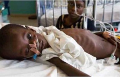 Adquisición de un concentrador de oxígeno médico para el Hospital Pediátrico de St. Damien de Haití